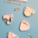 일산제일치과의원 이미지