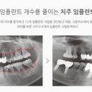 연세이튼튼치과의원 네이버블로그