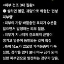 닥터의경고 ㅡ피부건조 이미지