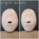 아델리오 에스테틱 | 양재동 피부관리 아델리오 에스테틱 위치.가격.시간.후기