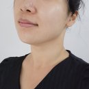 수곡제일약국 | 청주 수곡동 에르벨에스테틱 수곡점 윤곽관리 뱀부윤곽관리 후기