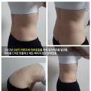 SNPE 바른자세 척추운동 이미지