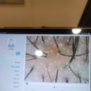 탈모케어존부산 이미지