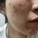 밝은얼굴의원 이미지