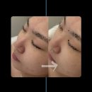 신명메디칼 | 올가드림뷰티 | 영통역 피부관리샵 추천 수부지 고민 해결 💆🏻‍♀️