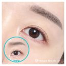 송도비앤미의원 | 부천 상동 눈썹문신으로 제일 자연스러운 비앤미