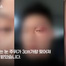 고속도로 한복판에서 니킥과 돌려차기를 한 50대 남성 이미지