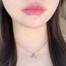 차오름타임 | 청담초 피부과｜웨딩 관리 목주름차오름 필러 한달 후기 리터치 포함