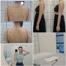 금강헬스케어 | 검단다이어트 예신 승모 팔뚝살 뿌수기 뷰티바이니