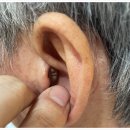 365보청기 이미지