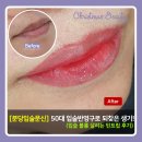 틴트플레이스 | [분당입술문신] 50대 입술반영구로 되찾은 생기｜입술 볼륨 살리는 틴트립 후기
