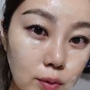 인셀덤사용찐후기
