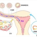 아이사랑산부인과의원 네이버블로그