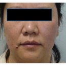 유앤아이의원 구로점 | 구로디지털단지 인모드, 후기 극과 극인 이유?