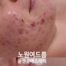 노원역 5번출구 이미지