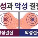 성모갑유정외과의원 네이버블로그