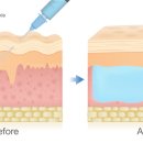 닥터디자이너의원 광주점 이미지
