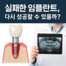 [방배서울하이안치과] 재수술 임플란트 3편 – 실제 환자 케이스로 보는 성공 전략