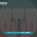 백세튼튼치과의원 네이버블로그