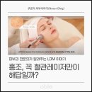MS에너지(주) | 홍조, 꼭 혈관레이저만이 해답일까? 피부과 전문의가 설명하는 LDM치료