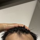 PLAY PUB | 프로페시아 처방 효과 성기능 부작용 있을까? 복용 후기