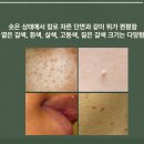 채움플러스의원 별내 네이버블로그