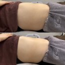 김천 전신림프케어 전문 강스킨케어입니다.