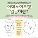 아이누리한의원 광명점 | 축농증, 방치하지 말고 건강하게 관리해요!
