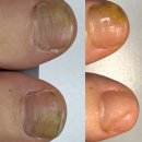 리더스프라자 앞 | [화성] 병점무좀발톱 관리 잘 하는 곳 : 온뷰티 오벨리네일푸스 족보있는그녀들 화성 병점점