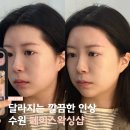 페이스에듀 | 광교왁싱 이마 헤어라인 교정 수원 페이스 왁싱 ‘ 브로우돌 ’ 관리 후기