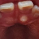 분당어린이치과의원 이미지