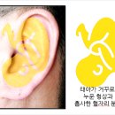 셀비오두피탈모&건강 네이버블로그