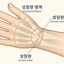 연세다움병원 | 성장판검사 받기 전, 꼭 알아야 할 병원 정보와 비용 (2025)