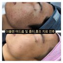 더플랜디