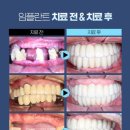 강남애프터치과 이미지