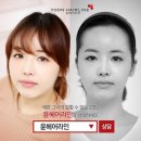 라인헤어 이미지