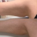 원한의원 | [내돈내산] 19만원 다이어트? 그램한의원 한달후기(-4kg)