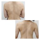 선메디칼(주) | [뷰티] 드레스라인 관리 | 평택 선새김에스테틱 방문후기