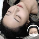 강남대로 405 | 강남 헤어라인 두피문신, m자탈모 커버 탈각후기