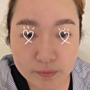 볼지메디 | 인천피부관리 데자뷰메디스킨 인천점 수분초음파 관리 후기