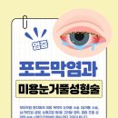 오산현안과 의원 | "포도막염 진단 후 미용 눈꺼풀 성형, 괜찮을까?" [오산강남성형외과]