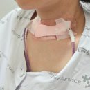 용인세브란스 갑상선암 전절제 및 양측 림프절 곽청술 수술 후기 (이초록교수님)