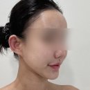 한적1길 | 공주윤곽관리 뱀부테라피 뱀부윤곽관리 잘하는 곳 르미왁싱 후기