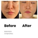 상남동216 | 창원피부관리 에린뷰티 상남동 브라질리언왁싱 수분관리