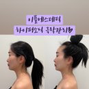 이플라라