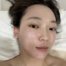 리뮤즈 | 이수역 피부관리 리뮤즈 | 여드름 피부전문 슈퍼젝션 관리 후기