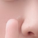 리노성형외과의원 네이버블로그