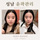 중원도촌-A-14 | 성남 윤곽관리 약손명가 분당모란점 맞춤 얼굴라인 정리 받은 솔직후기