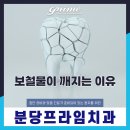 프라임치과 티스토리