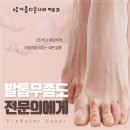 선진세탁크리닉 | 발톱무좀병원 어디서 해야 나아질까?